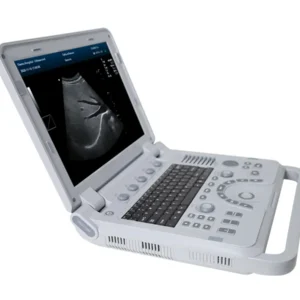 ULTRASONIDO DOPPLER CMS1700A – CONTEC