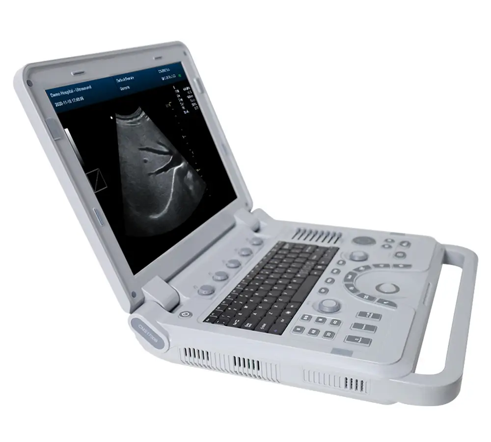 ultrasonido doppler CMS1700A CORP ESAP HN