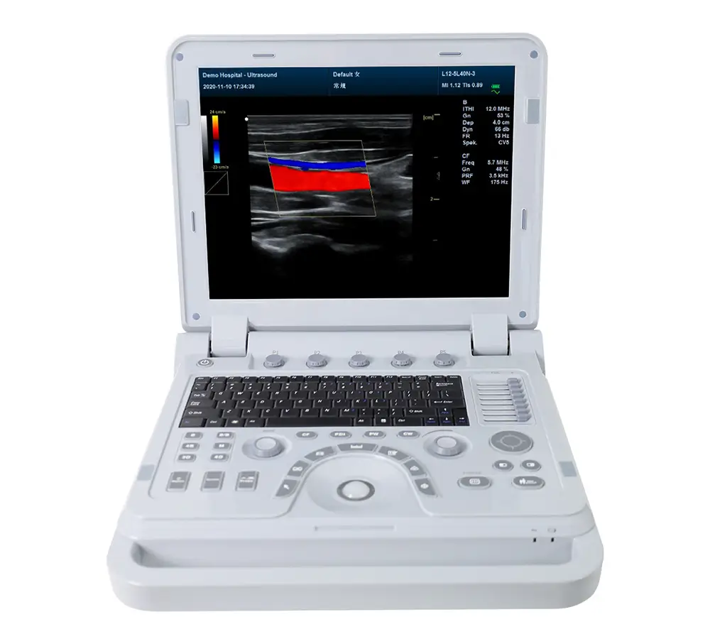 ULTRASONIDO DOPPLER CMS1700A - CONTEC - Imagen 2