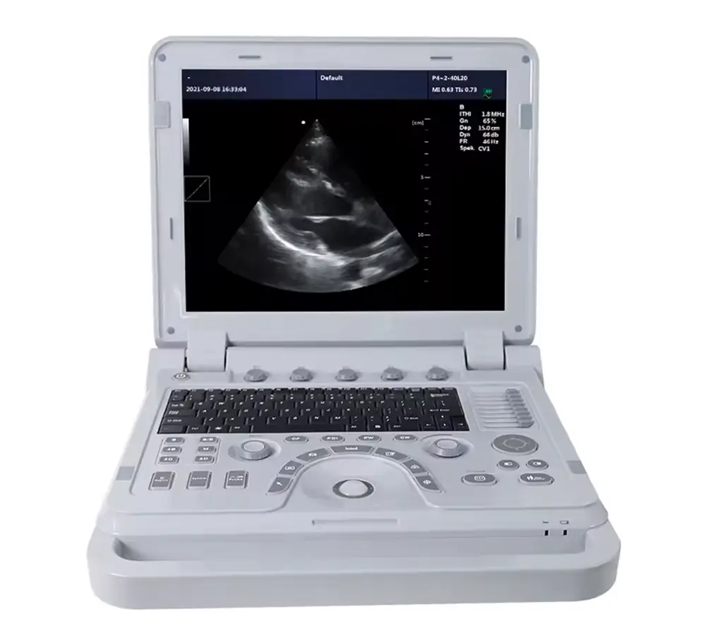 ultrasonido doppler CMS1700A CORP ESAP HN