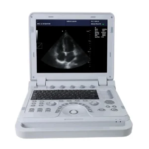 Ecógrafo contec CMS 1700