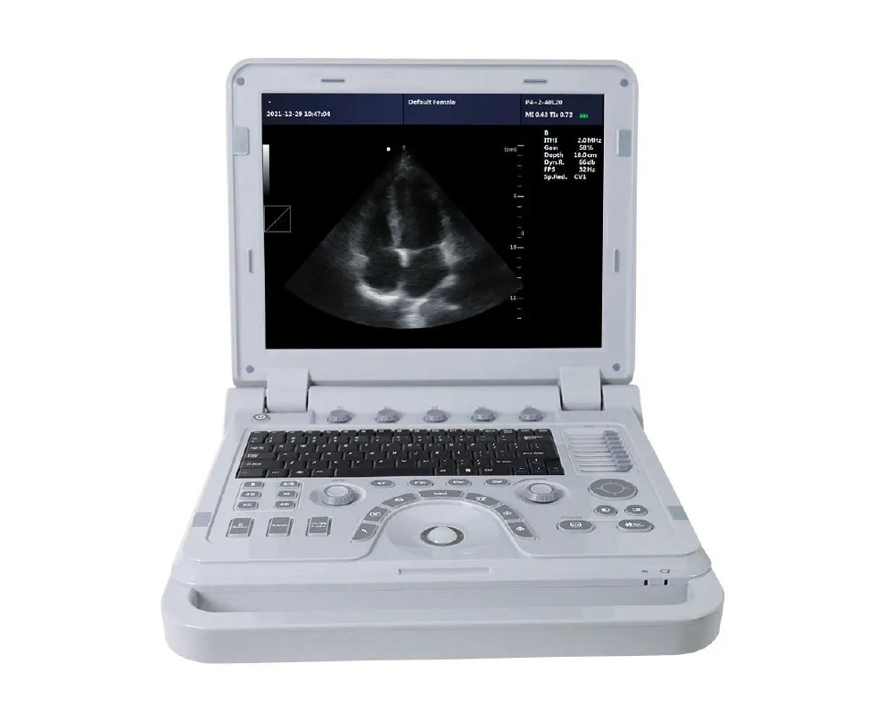 Ecógrafo contec CMS 1700